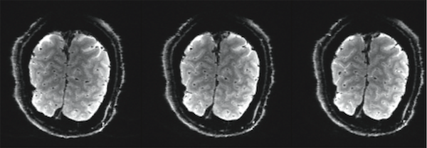 1 x 1 x 1mm resolution Single-shot gradient echo EPI, TE=30