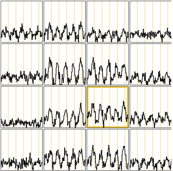 1 x 1 x 1mm resolution Single-shot gradient echo EPI, TE=30