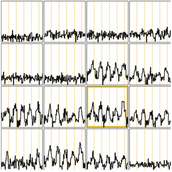 0.75 x 0.75 x 0.75mm resolution Single-shot gradient echo EPI, TE=31